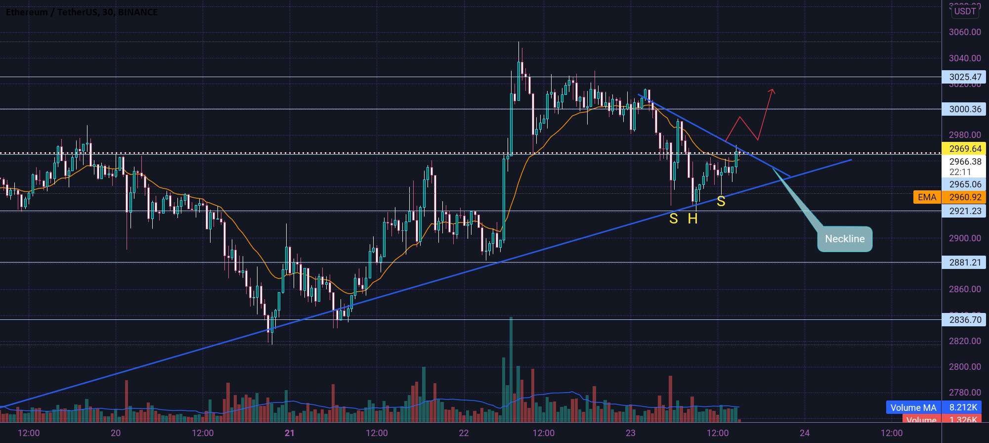  تحلیل اتریوم - ETH مانند H&S شکل گرفت 🤓↗️✅↗️🤓