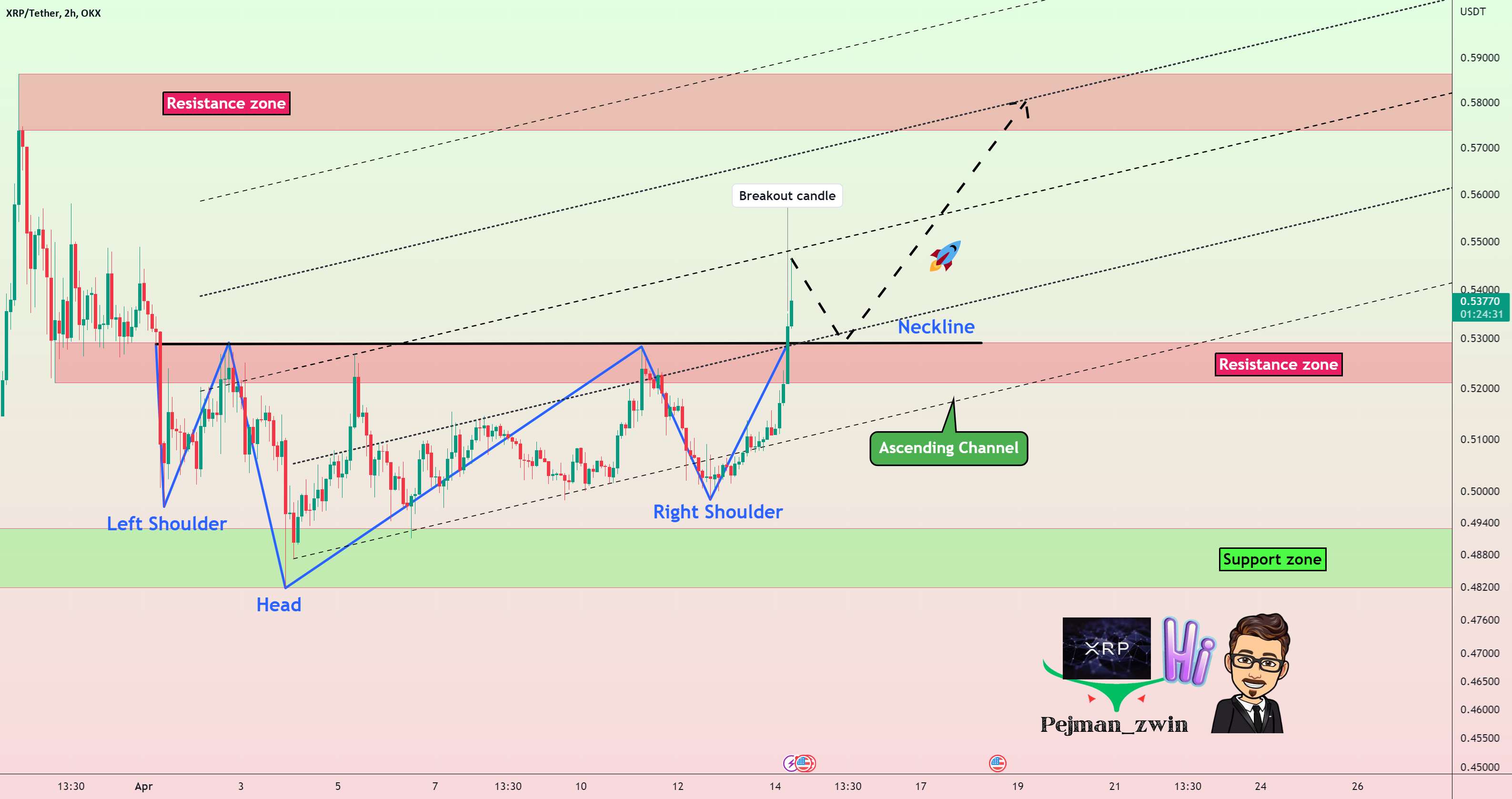  تحلیل ریپل - حداقل 10 درصد رشد XRP توسط Inverse H&S Pattern🚀