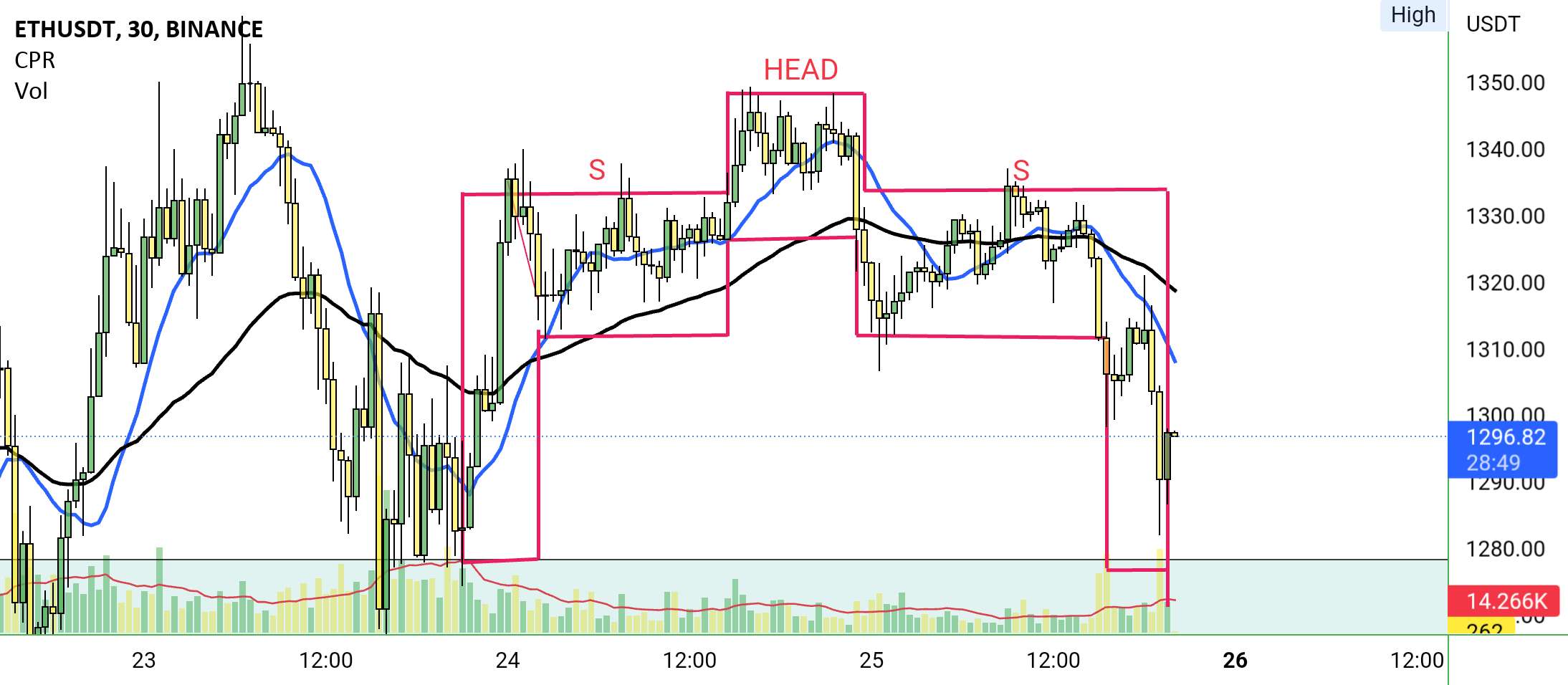 #ETH/USDT#